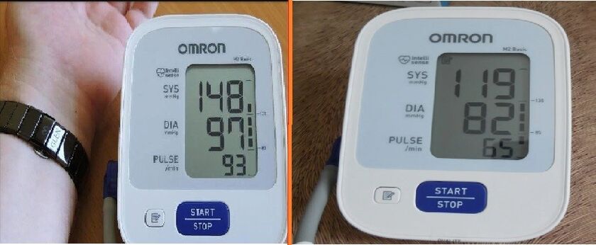 Tonometer readings before and after taking Cardione